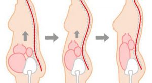 内臓の位置改善