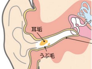 耳垢の発生場所