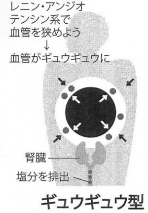 ギュウギュウ型