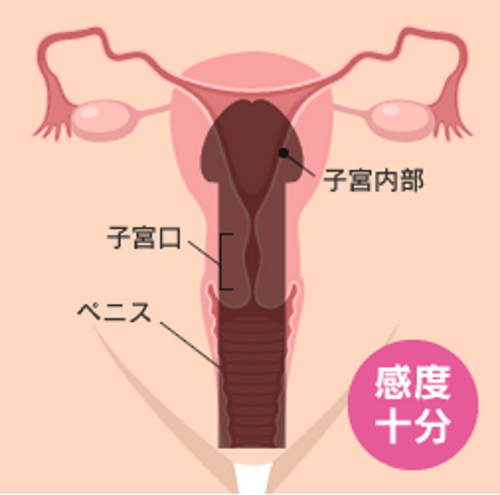 ペニスと膣の相性