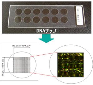 サインポスト遺伝子検査