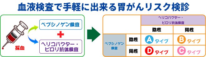 胃がんリスク検診