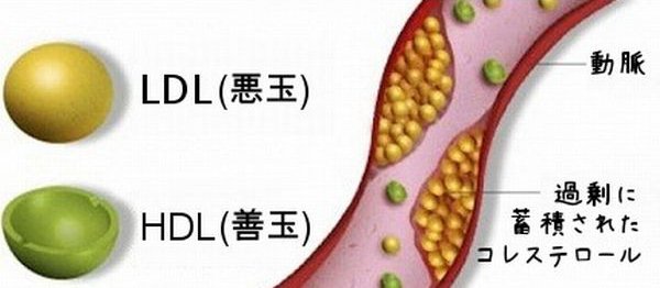 LDLと高血圧