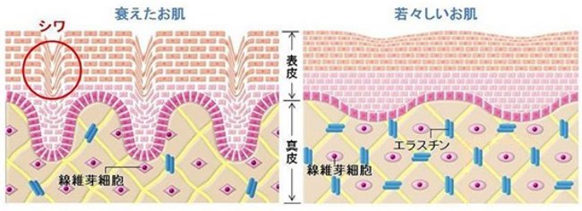 真皮ジワのメカニズム