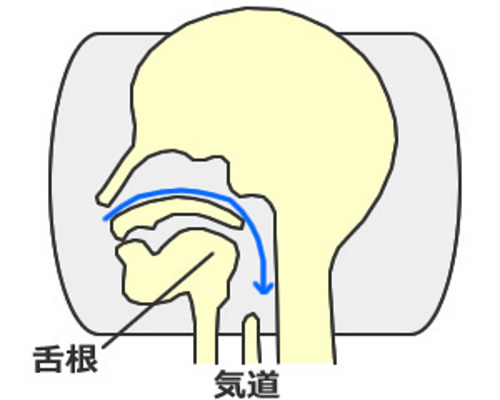 いびきの解消