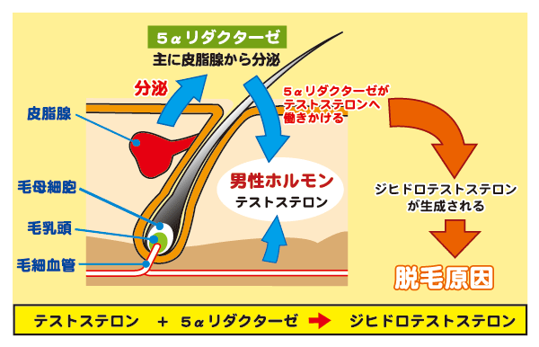 5αリダクターゼ